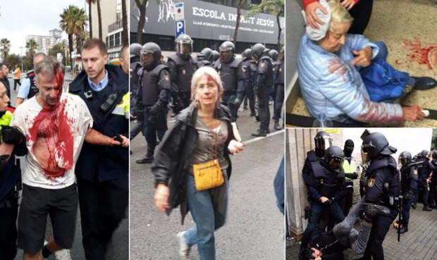 Εικόνες ντροπής από τις “ματωμένες” κάλπες στην Καταλονία-460 οι τραυματίες.