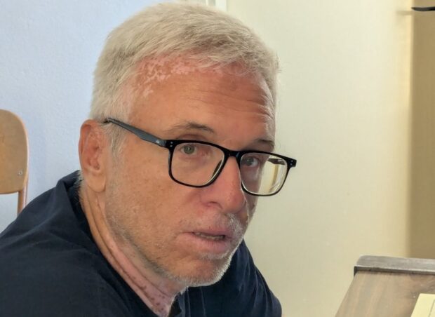 Παναγιώτης Σπανός: «Eνα δημόσιο σύστημα επείγουσας φροντίδας, δεν μπορεί να  στηρίζεται μόνιμα στο φιλότιμο και στην εξάντληση του προσωπικού»
